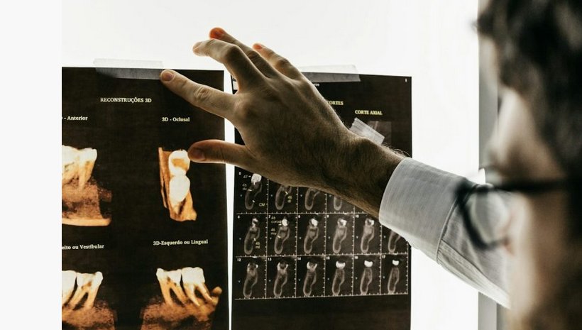 DVT 3D Diagnostik
