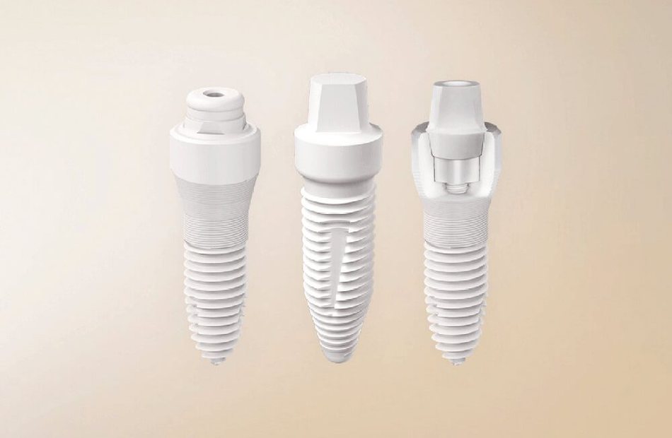 Keramikimplantate